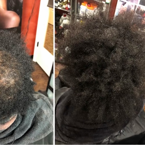 Hair Growth Olive Moringa Oil - Picture 7 of 8